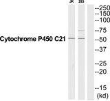 CYP21 / Steroid 21-Hydroxylase Antibody - Western blot analysis of extracts from Jurkat/293 cells, using CYP21A2 antibody.