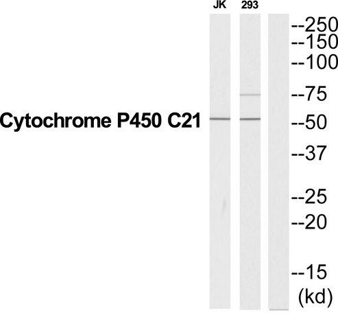 CYP21 / Steroid 21-Hydroxylase Antibody - Western blot analysis of extracts from Jurkat/293 cells, using CYP21A2 antibody.