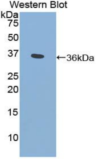 CYP21A2 Antibody - Western blot of recombinant CYP21A2.