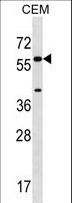 CYP21A2 Antibody - CYP21A2 Antibody western blot of CEM cell line lysates (35 ug/lane). The CYP21A2 antibody detected the CYP21A2 protein (arrow).