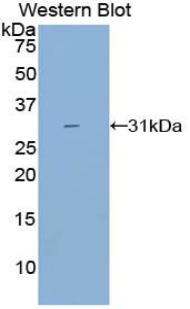 CYP21A2 Antibody - Western blot of recombinant CYP21A2.