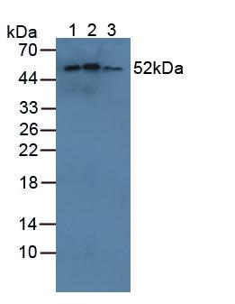 CYP21A2 Antibody - Western Blot; Sample: Lane1: Human 293T Cells; Lane2: Human Jurkat Cells; Lane3: Human HL-60 Cells.