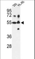 CYP21A2 Antibody - Western blot of CYP21A2 Antibody in 293, HL-60 cell line lysates (35 ug/lane). CYP21A2 (arrow) was detected using the purified antibody.