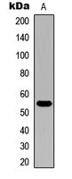 CYP21A2 Antibody - Western blot analysis of Cytochrome P450 21A2 expression in HeLa (A) whole cell lysates.