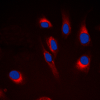 CYP21A2 Antibody - Immunofluorescent analysis of Cytochrome P450 21A2 staining in HeLa cells. Formalin-fixed cells were permeabilized with 0.1% Triton X-100 in TBS for 5-10 minutes and blocked with 3% BSA-PBS for 30 minutes at room temperature. Cells were probed with the primary antibody in 3% BSA-PBS and incubated overnight at 4 deg C in a humidified chamber. Cells were washed with PBST and incubated with a DyLight 594-conjugated secondary antibody (red) in PBS at room temperature in the dark. DAPI was used to stain the cell nuclei (blue).