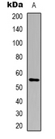 CYP21A2 Antibody - Western blot analysis of Cytochrome P450 21A2 expression in Jurkat (A) whole cell lysates.