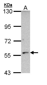CYP21A2 Antibody - Sample (30 ug of whole cell lysate). A: Molt-4. 7.5% SDS PAGE. CYP21A2 antibody diluted at 1:1000. 