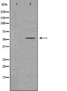 CYP21A2 Antibody - Western blot analysis of extracts of 293 cells using Cytochrome P450 21A2 antibody. The lane on the left is treated with the antigen-specific peptide.