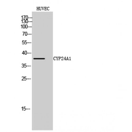 CYP24 / CYP24A1 Antibody - Western blot of CYP24A1 antibody