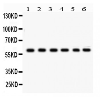 CYP24 / CYP24A1 Antibody - CYP24A1 antibody Western blot. All lanes: Anti CYP24A1 at 0.5 ug/ml. Lane 1: Rat Thymus Tissue Lysate at 50 ug. Lane 2: Rat Lung Tissue Lysate at 50 ug. Lane 3: HELA Whole Cell Lysate at 40 ug. Lane 4: 22RV1 Whole Cell Lysate at 40 ug. Lane 5: A431 Whole Cell Lysate at 40 ug. Lane 6: HEPA Whole Cell Lysate at 40 ug. Predicted band size: 59 kD. Observed band size: 59 kD.