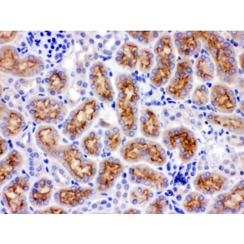 CYP24 / CYP24A1 Antibody - CYP24A1 antibody IHC-paraffin. IHC(P): Rat Kidney Tissue.