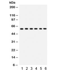 CYP24 / CYP24A1 Antibody