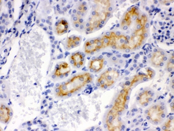 CYP24 / CYP24A1 Antibody