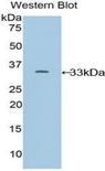CYP24 / CYP24A1 Antibody - Western blot of recombinant CYP24 / CYP24A1.  This image was taken for the unconjugated form of this product. Other forms have not been tested.