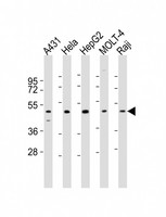 CYP24 / CYP24A1 Antibody - All lanes : Anti-CYP24A1 Antibody at 1:2000 dilution Lane 1: A431 whole cell lysates Lane 2: HeLa whole cell lysates Lane 3: HepG2 whole cell lysates Lane 4: MOLT-4 whole cell lysates Lane 5: Raji whole cell lysates Lysates/proteins at 20 ug per lane. Secondary Goat Anti-Rabbit IgG, (H+L), Peroxidase conjugated at 1/10000 dilution Predicted band size : 59 kDa Blocking/Dilution buffer: 5% NFDM/TBST.