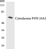 CYP24 / CYP24A1 Antibody - Western blot analysis of the lysates from HepG2 cells using Cytochrome P450 24A1 antibody.