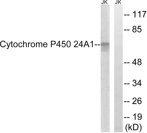 CYP24 / CYP24A1 Antibody - Western blot analysis of lysates from JurKat cells, using Cytochrome P450 24A1 Antibody. The lane on the right is blocked with the synthesized peptide.