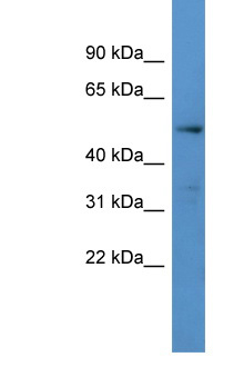 CYP24 / CYP24A1 Antibody - CYP24A1 / CYP24 antibody Western blot of Placenta lysate. Antibody concentration 1 ug/ml.  This image was taken for the unconjugated form of this product. Other forms have not been tested.