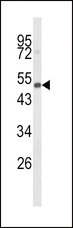 CYP24 / CYP24A1 Antibody - Western blot of CYP24A1 Antibody in mouse spleen tissue lysates (35 ug/lane). CYP24A1 (arrow) was detected using the purified antibody.