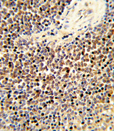 CYP24 / CYP24A1 Antibody - Formalin-fixed and paraffin-embedded human spleen tissue reacted with CYP24A1 Antibody , which was peroxidase-conjugated to the secondary antibody, followed by DAB staining. This data demonstrates the use of this antibody for immunohistochemistry; clinical relevance has not been evaluated.