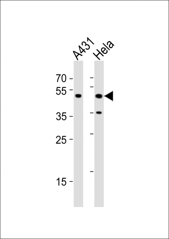 CYP24 / CYP24A1 Antibody - All lanes : Anti-CYP24A1 Antibody at 1:1000 dilution Lane 1: A431 whole cell lysates Lane 2: HeLa whole cell lysates Lysates/proteins at 20 ug per lane. Secondary Goat Anti-Rabbit IgG, (H+L), Peroxidase conjugated at 1/10000 dilution Predicted band size : 59 kDa Blocking/Dilution buffer: 5% NFDM/TBST.