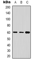 CYP24 / CYP24A1 Antibody - Western blot analysis of Cytochrome P450 24A1 expression in Jurkat (A); A431 (B); HepG2 (C) whole cell lysates.