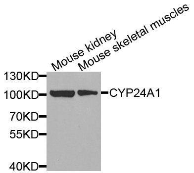 CYP24 / CYP24A1 Antibody - Western blot analysis of extracts of various cell lines, using CYP24A1 antibody at 1:1000 dilution. The secondary antibody used was an HRP Goat Anti-Rabbit IgG (H+L) at 1:10000 dilution. Lysates were loaded 25ug per lane and 3% nonfat dry milk in TBST was used for blocking.