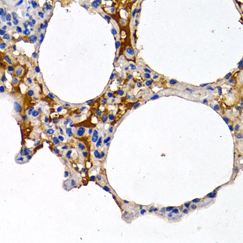 CYP24 / CYP24A1 Antibody - Immunohistochemistry of paraffin-embedded rat lung using CYP24A1 antibodyat dilution of 1:200 (40x lens).