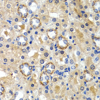 CYP24 / CYP24A1 Antibody - Immunohistochemistry of paraffin-embedded rat kidney using CYP24A1 antibodyat dilution of 1:200 (40x lens).