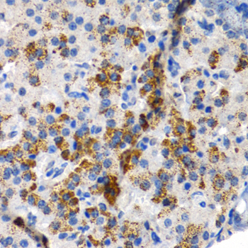 CYP24 / CYP24A1 Antibody - Immunohistochemistry of paraffin-embedded rat pancreas using CYP24A1 antibodyat dilution of 1:200 (40x lens).