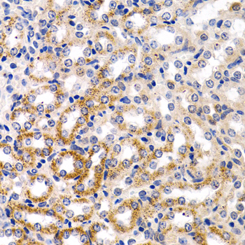 CYP24 / CYP24A1 Antibody - Immunohistochemistry of paraffin-embedded mouse kidney using CYP24A1 antibodyat dilution of 1:200 (40x lens).