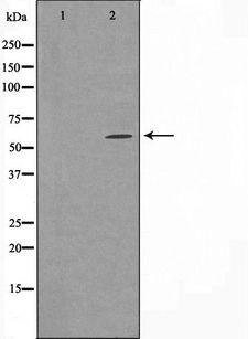 CYP24 / CYP24A1 Antibody - Western blot analysis of extracts of HuvEc cells using Cytochrome P450 24A1 antibody. The lane on the left is treated with the antigen-specific peptide.