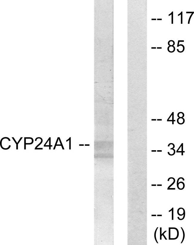 CYP24 / CYP24A1 Antibody - Western blot analysis of extracts from HUVEC cells, using Cytochrome P450 24A1 antibody.