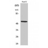 CYP26 / CYP26A1 Antibody - Western blot of CYP26A1 antibody