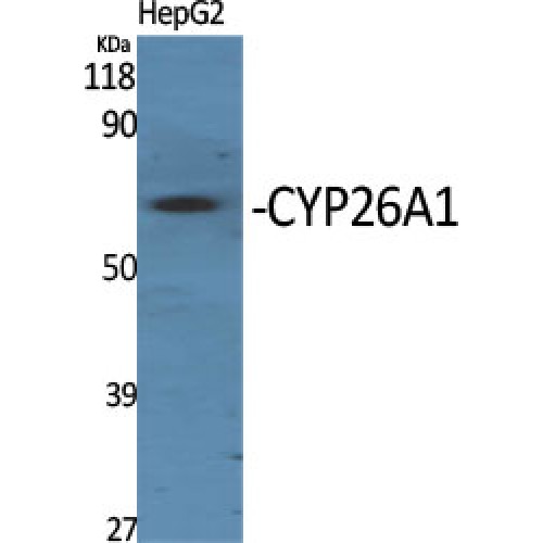 CYP26 / CYP26A1 Antibody - Western blot of CYP26A1 antibody