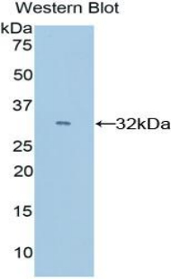 CYP26 / CYP26A1 Antibody - Western blot of recombinant CYP26 / CYP26A1.  This image was taken for the unconjugated form of this product. Other forms have not been tested.