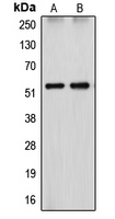 CYP26 / CYP26A1 Antibody - Western blot analysis of Cytochrome P450 26A1 expression in HepG2 (A); HEK293T (B) whole cell lysates.