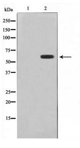 CYP26 / CYP26A1 Antibody - Western blot of HepG2 cell lysate using Cytochrome P450 26A1 Antibody