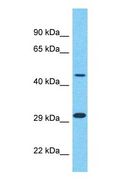 CYP26 / CYP26A1 Antibody - Western blot of CYP26A1 Antibody with human Fetal Liver lysate.  This image was taken for the unconjugated form of this product. Other forms have not been tested.