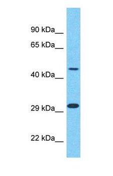 CYP26 / CYP26A1 Antibody - Western blot of CYP26A1 Antibody with human Fetal Liver lysate.  This image was taken for the unconjugated form of this product. Other forms have not been tested.