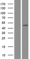 CYP26 / CYP26A1 Protein - Western validation with an anti-DDK antibody * L: Control HEK293 lysate R: Over-expression lysate