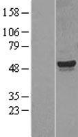 CYP26 / CYP26A1 Protein - Western validation with an anti-DDK antibody * L: Control HEK293 lysate R: Over-expression lysate