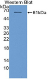 CYP26B1 Antibody - Western blot of recombinant CYP26B1.