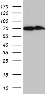 CYP26B1 Antibody - HEK293T cells were transfected with the pCMV6-ENTRY control. (Left lane) or pCMV6-ENTRY CYP26B1. (Right lane) cDNA for 48 hrs and lysed. Equivalent amounts of cell lysates. (5 ug per lane) were separated by SDS-PAGE and immunoblotted with anti-CYP26B1. (1:2000)