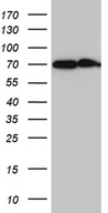 CYP26B1 Antibody - HEK293T cells were transfected with the pCMV6-ENTRY control. (Left lane) or pCMV6-ENTRY CYP26B1. (Right lane) cDNA for 48 hrs and lysed. Equivalent amounts of cell lysates. (5 ug per lane) were separated by SDS-PAGE and immunoblotted with anti-CYP26B1. (1:2000)