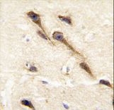 CYP26B1 Antibody - Formalin-fixed and paraffin-embedded human brain tissue reacted with CYP26B1 antibody , which was peroxidase-conjugated to the secondary antibody, followed by DAB staining. This data demonstrates the use of this antibody for immunohistochemistry; clinical relevance has not been evaluated.
