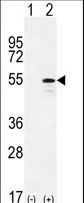 CYP26B1 Antibody - Western blot of CYP26B1 (arrow) using rabbit polyclonal CYP26B1 Antibody. 293 cell lysates (2 ug/lane) either nontransfected (Lane 1) or transiently transfected (Lane 2) with the CYP26B1 gene.