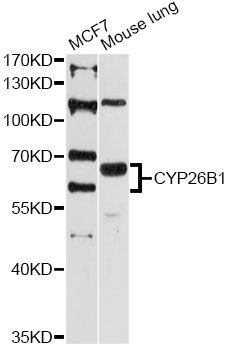 CYP26B1 Antibody - Western blot analysis of extracts of various cell lines, using CYP26B1 antibody at 1:3000 dilution. The secondary antibody used was an HRP Goat Anti-Rabbit IgG (H+L) at 1:10000 dilution. Lysates were loaded 25ug per lane and 3% nonfat dry milk in TBST was used for blocking. An ECL Kit was used for detection and the exposure time was 90s.