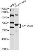 CYP26B1 Antibody - Western blot analysis of extracts of various cell lines, using CYP26B1 antibody at 1:3000 dilution. The secondary antibody used was an HRP Goat Anti-Rabbit IgG (H+L) at 1:10000 dilution. Lysates were loaded 25ug per lane and 3% nonfat dry milk in TBST was used for blocking. An ECL Kit was used for detection and the exposure time was 90s.