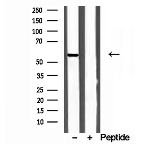 CYP26B1 Antibody - Western blot analysis of extracts of L02 cells using CYP26B1 antibody.